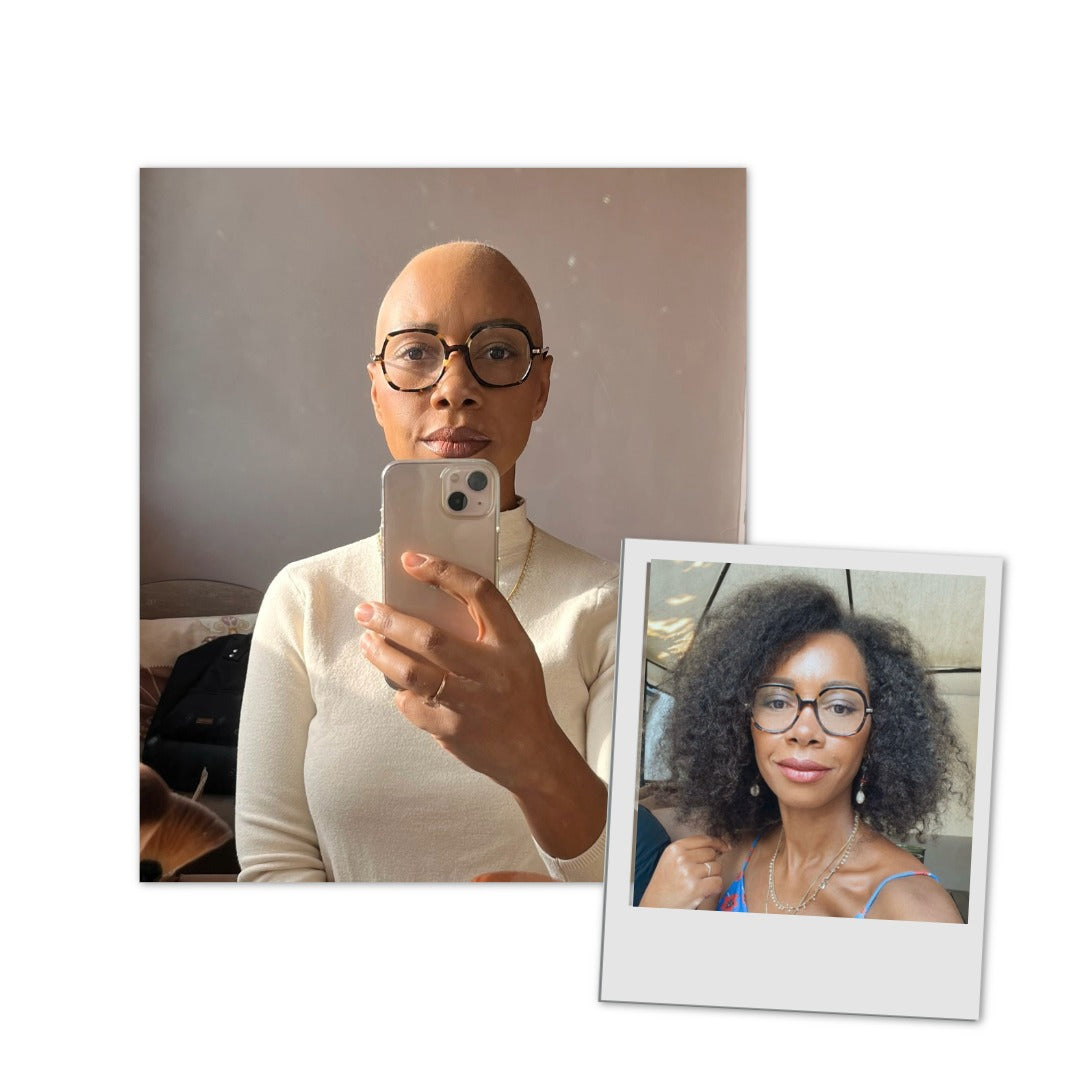 Le combat de Sandrine Sophie prendre soin des cheveux, alors qu'elle perd les seins d'un cancer du sein en 2022